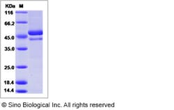 Sino Biological Dengue virus (DENV) (type 4, strain Philippines/H241/1956)
