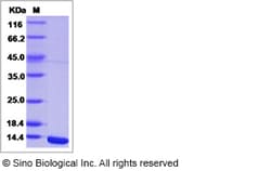 Sino Biological West Nile Virus (WNV) (lineage 2, strain Nea Santa-Greece-2010)