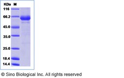 Sino Biological Coxsackievirus A16 (Cox A16) (strain G-10) VP1 Protein