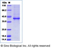 Sino Biological Zika virus (ZIKV) (strain Zika SPH2015) ZIKV-E (Stem/anchor