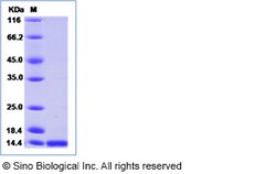 Sino Biological Zika virus (ZIKV) (strain Zika SPH2015) ZIKV-E / Envelope