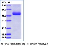 Sino Biological Zika virus (ZIKV) (strain Zika SPH2015) ZIKV-NS1 protein