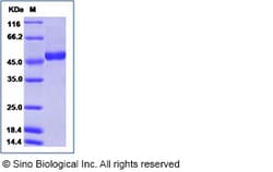 Sino Biological Zika virus (ZIKV) (strain Zika SPH2015) ZIKV-NS1 protein