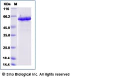 Sino Biological Zika virus (ZIKV) (strain Zika SPH2015) ZIKV-NS5 protein