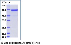 Sino Biological Influenza A H5N6 (A/yunnan/0127/2015) Hemagglutinin / HA