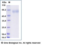 Sino Biological Influenza A H1N1 (A/Michigan/45/2015) Hemagglutinin / HA1