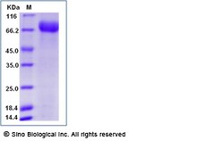 Sino Biological Influenza A H3N2 (A/Hong Kong/4801/2014) Neuraminidase