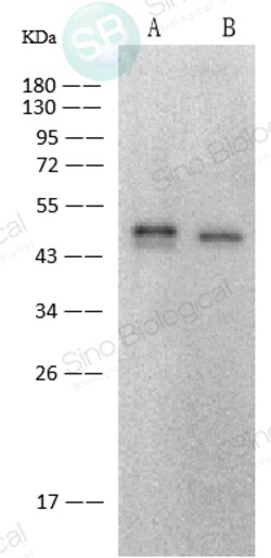 Sino Biological SARS-CoV-2 (2019-nCoV) Nucleocapsid Antibody, Rabbit MAb,