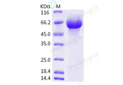 Sino Biological Human coronavirus (HCoV-OC43) Hemagglutinin esterase Protein