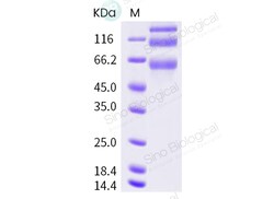 Sino Biological Human coronavirus (HCoV-OC43) Spike Protein (S1+S2 ECD,