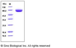 Sino Biological Recombinant Mouse BACE1 Protein (His Tag), Quantity: Each