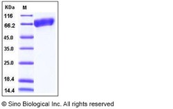 Sino Biological Mouse ALCAM / CD166 Protein (His Tag) 100ug, Quantity:
