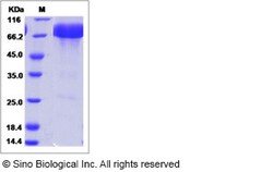 Sino Biological Recombinant Mouse PD-L1/B7-H1 Protein (ECD, hFc Tag), HPLC-verified,