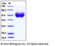 Sino Biological Mouse PD-L1 / B7-H1 / CD274 Protein (ECD,His Tag) 100ug,
