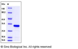 Sino Biological Recombinant Mouse BCL-xL/BCL2L1 Protein (aa 1-212, His