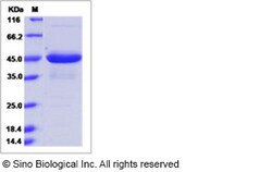 Sino Biological Recombinant Mouse Chemerin/RARRES2 Protein (hFc Tag), Quantity: