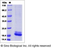 Sino Biological Mouse RARRES2 / TIG2 Protein (His Tag) 100ug, Quantity: