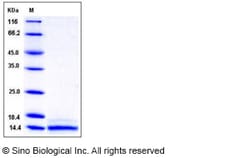 Sino Biological Recombinant Mouse CCL6 Protein (His Tag), Quantity: Each