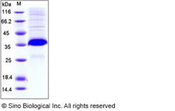 Sino Biological Mouse FLRG / Fstl3 Protein (His Tag) 50ug, Quantity: Each