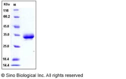 Sino Biological Recombinant Mouse Erythropoietin R/EPOR Protein (His Tag),