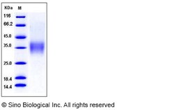 Sino Biological Recombinant Mouse CD16-2/FCGR4/Fc gamma RIV Protein (His