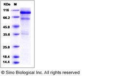 Sino Biological Mouse HGF / Hepatocyte Growth Factor Protein 100ug, Quantity: