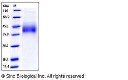 Sino Biological Recombinant Mouse Growth Hormone Receptor Protein (His