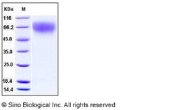 Sino Biological Mouse CD62L / L-Selectin / SELL Protein (His Tag) 100ug,