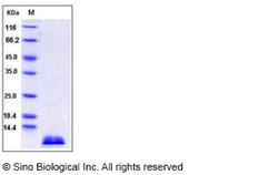 Sino Biological Recombinant Mouse TARC/CCL17 Protein, Quantity: Each of