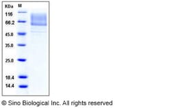 Sino Biological Recombinant Mouse LIMPII/SR-B2 Protein (His Tag), Quantity: