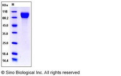 Sino Biological Mouse CSF1R / MCSF Receptor / CD115 Protein (His Tag),