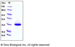 Sino Biological Recombinant Mouse Lipocalin-2/NGAL Protein (His Tag), HPLC-verified,