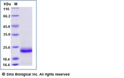 Sino Biological Recombinant Mouse Lipocalin-2/NGAL Protein, HPLC-verified,
