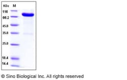 Sino Biological Recombinant Mouse IL-13 R alpha 2/IL13RA2 Protein (His