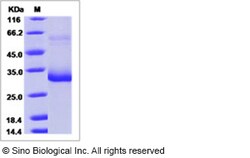 Sino Biological Recombinant Mouse Mannan Binding Lectin/MBL2 Protein (His