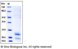 Sino Biological Mouse MIF / Migration Inhibitory Factor Protein (His Tag)
