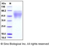 Sino Biological Mouse CD86 / B7-2 Protein (His Tag) 100ug, Quantity: Each