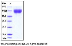 Sino Biological Mouse FGFR3 / CD333 Protein (His Tag) 100ug, Quantity: