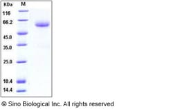 Sino Biological Mouse ALK-3 / BMPR1A Protein (His & Fc Tag) 200ug, Quantity: