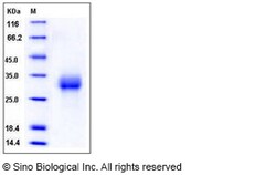 Sino Biological Mouse ALK-3 / BMPR1A Protein (His Tag) 200ug, Quantity: