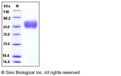 Sino Biological Recombinant Mouse CD64/FCGR1 Protein (His Tag), HPLC-verified,
