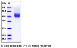 Sino Biological Recombinant Mouse CD64/FCGR1 Protein (His & AVI Tag), Biotinylated,