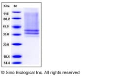 Sino Biological Recombinant Mouse IL-7R alpha/CD127 Protein (His Tag),