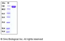 Sino Biological Recombinant Mouse IL-18Rα Protein (His & hFc Tag), Quantity: