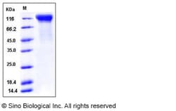 Sino Biological Recombinant Mouse IL-12 R beta 2/IL12RB2 Protein (His Tag),