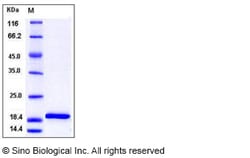 Sino Biological Mouse IL-1 beta / IL1B Protein 100ug, Quantity: Each of