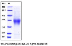 Sino Biological Mouse CD28 Protein (ECD, His Tag) 100ug, Quantity: Each