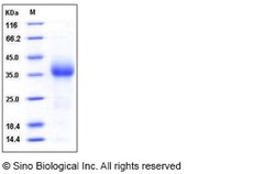 Sino Biological Mouse CD27 / TNFRSF7 Protein (His Tag) 100ug, Quantity: