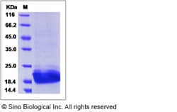 Sino Biological Recombinant Mouse PGRP-S/PGLYRP1 Protein (His Tag), Quantity: