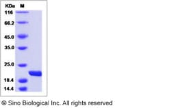 Sino Biological Recombinant Mouse IL-11 Protein, Quantity: Each of 1